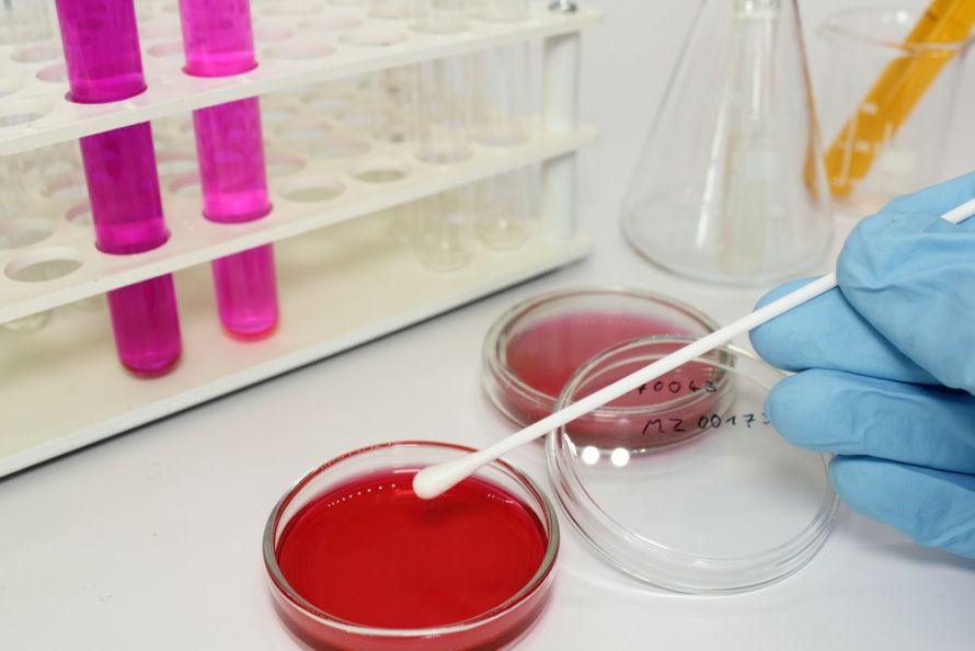 Abstrich für Herpes-Test im Labor